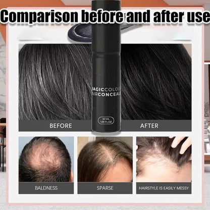 Scalp Concealer for Fuller, Natural-Looking Hair (BUY 1 GET 1 FREE)