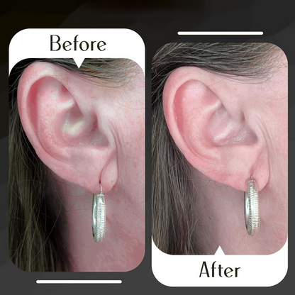 Premium Earlobe Support Patches (100 PCS)